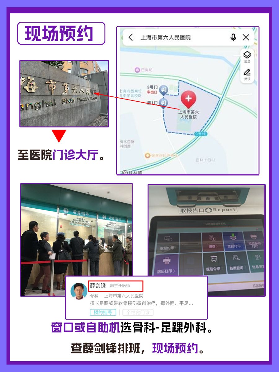 上海市第六人民医院薛剑锋医生怎么样？怎么挂号？