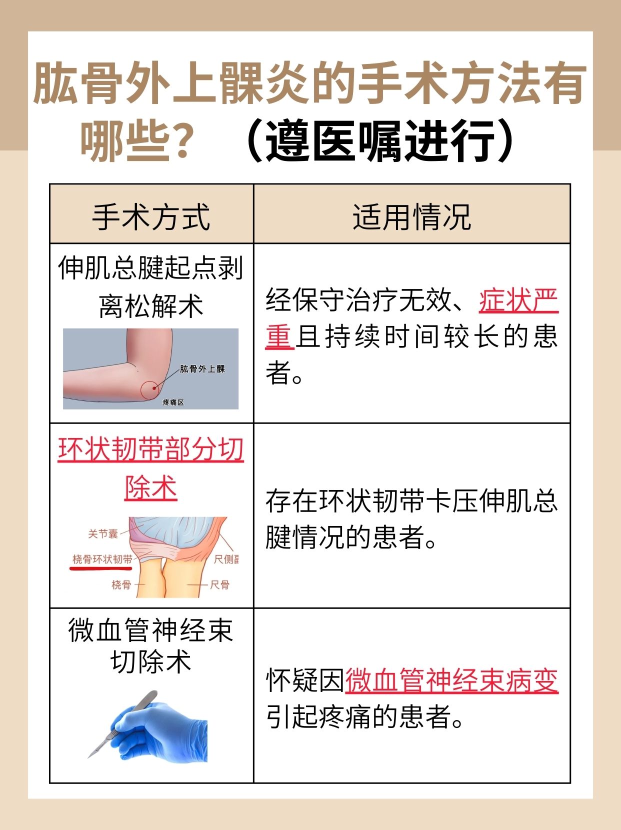 网球肘疼痛怎么治疗,你知道吗?
