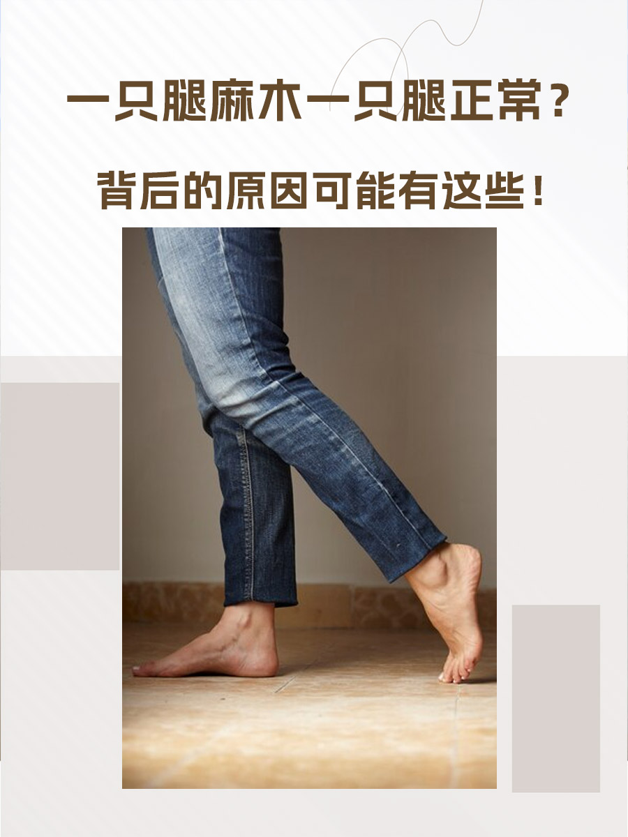 一只腿麻木一只腿正常?背后的原因可能有这些!