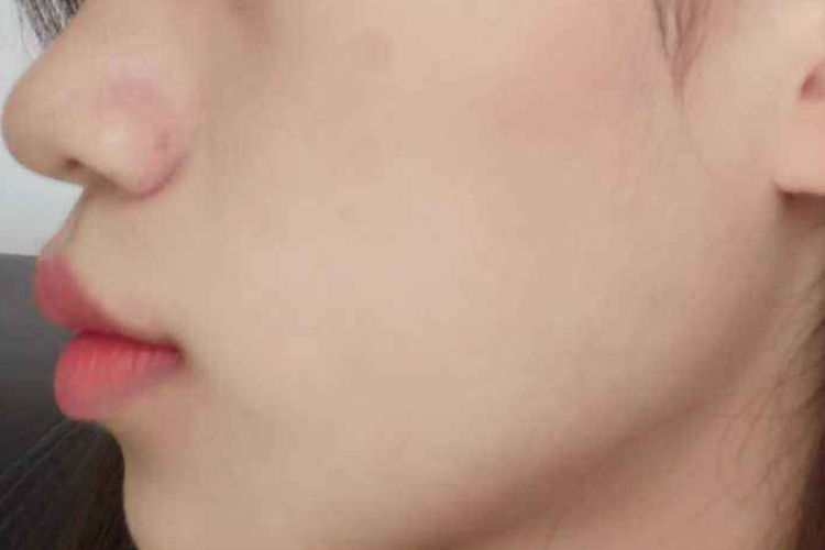 正常嘴唇侧面图