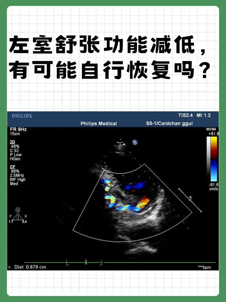 左室舒张功能减低，有可能自行恢复吗？