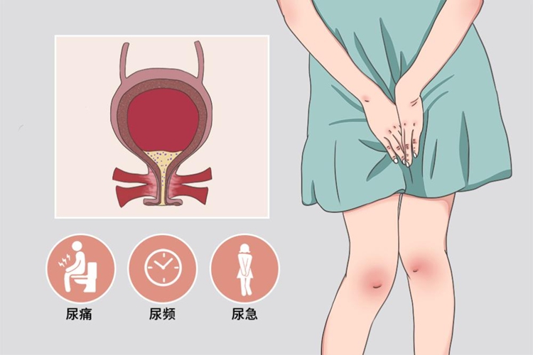 膀胱炎症状图