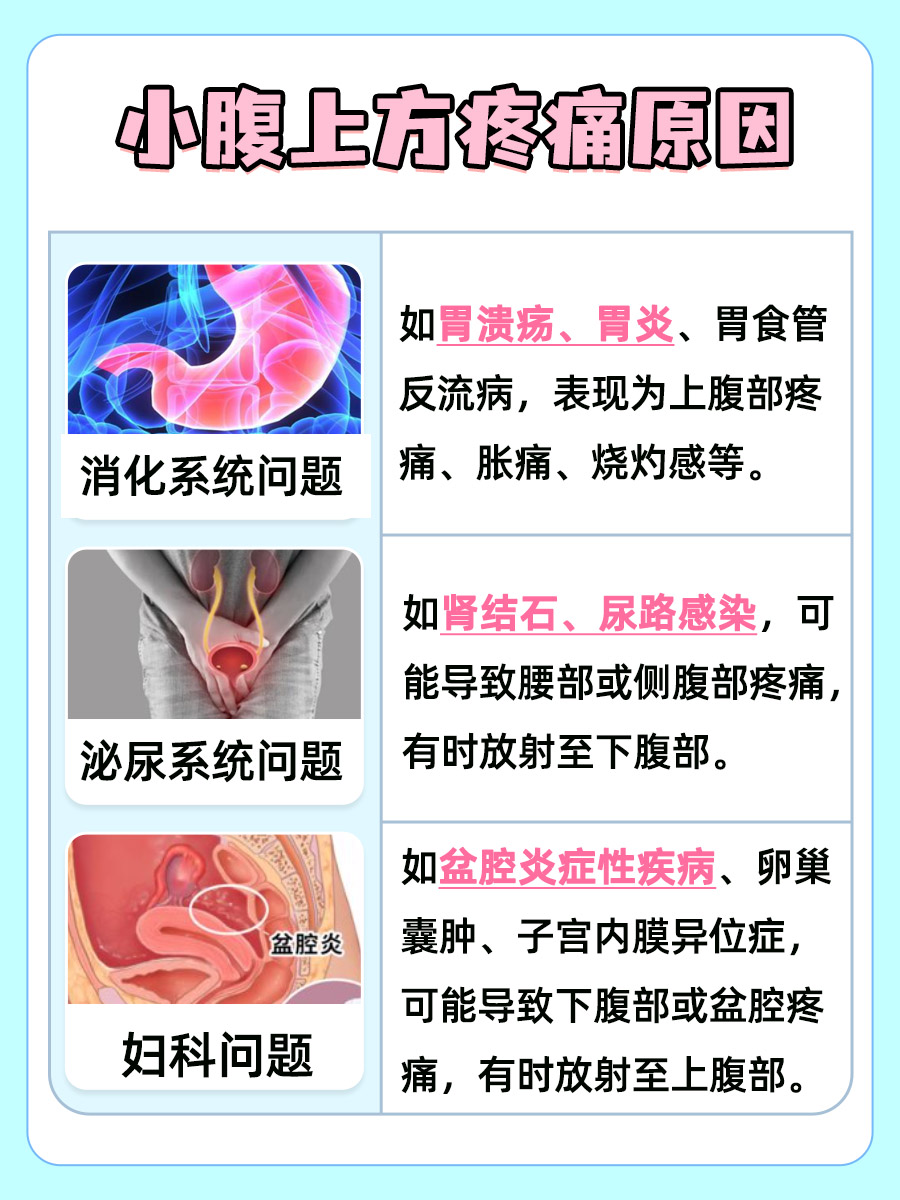小腹上方疼痛原因揭秘，可能是这些疾病