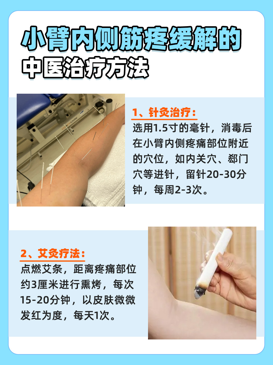 医生解析:小臂内侧筋疼的谜团