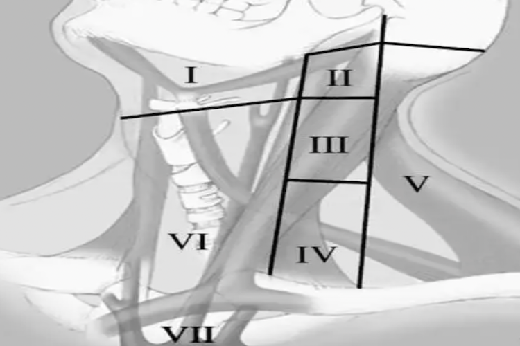 颈部淋巴结的分区图