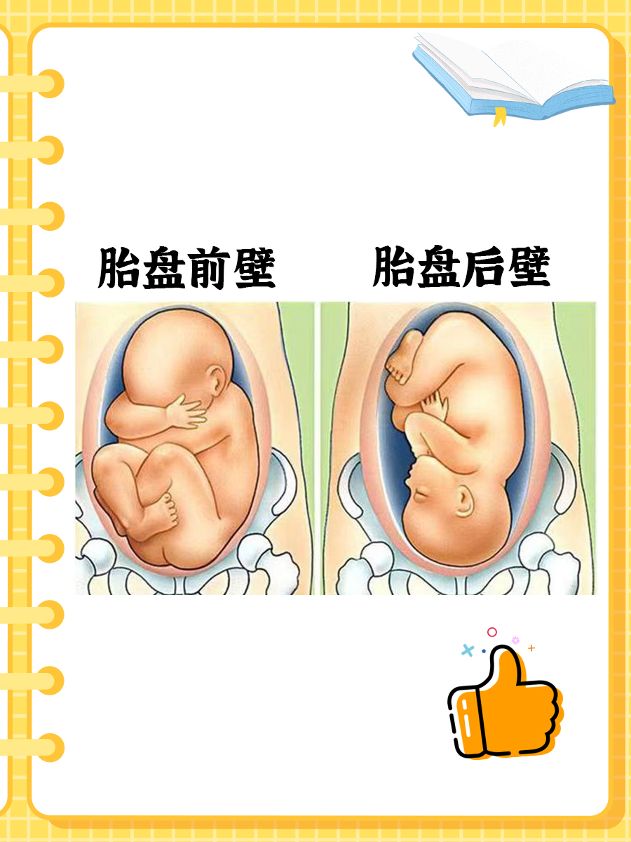 终于搞懂了胎盘前壁和胎盘后壁的区别