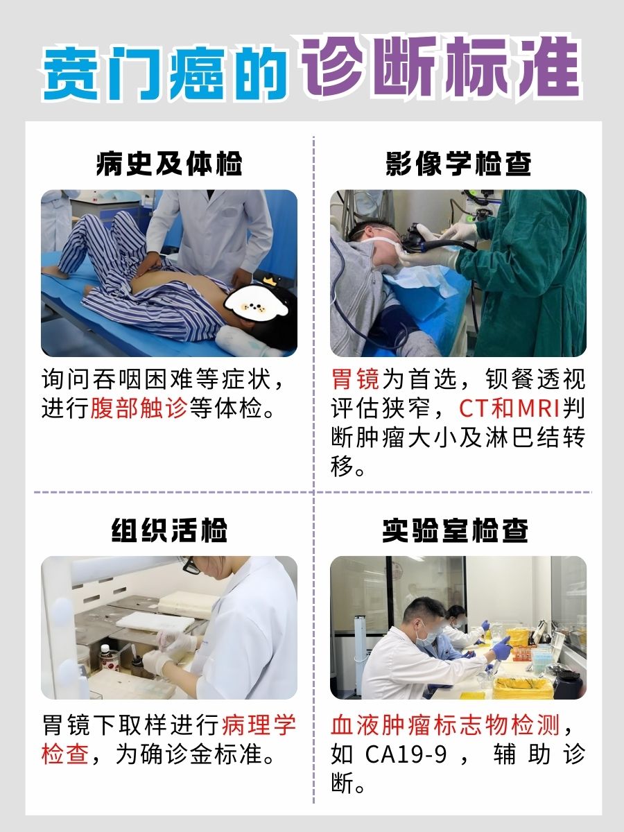 贲门癌是气出来的吗？那可未必！