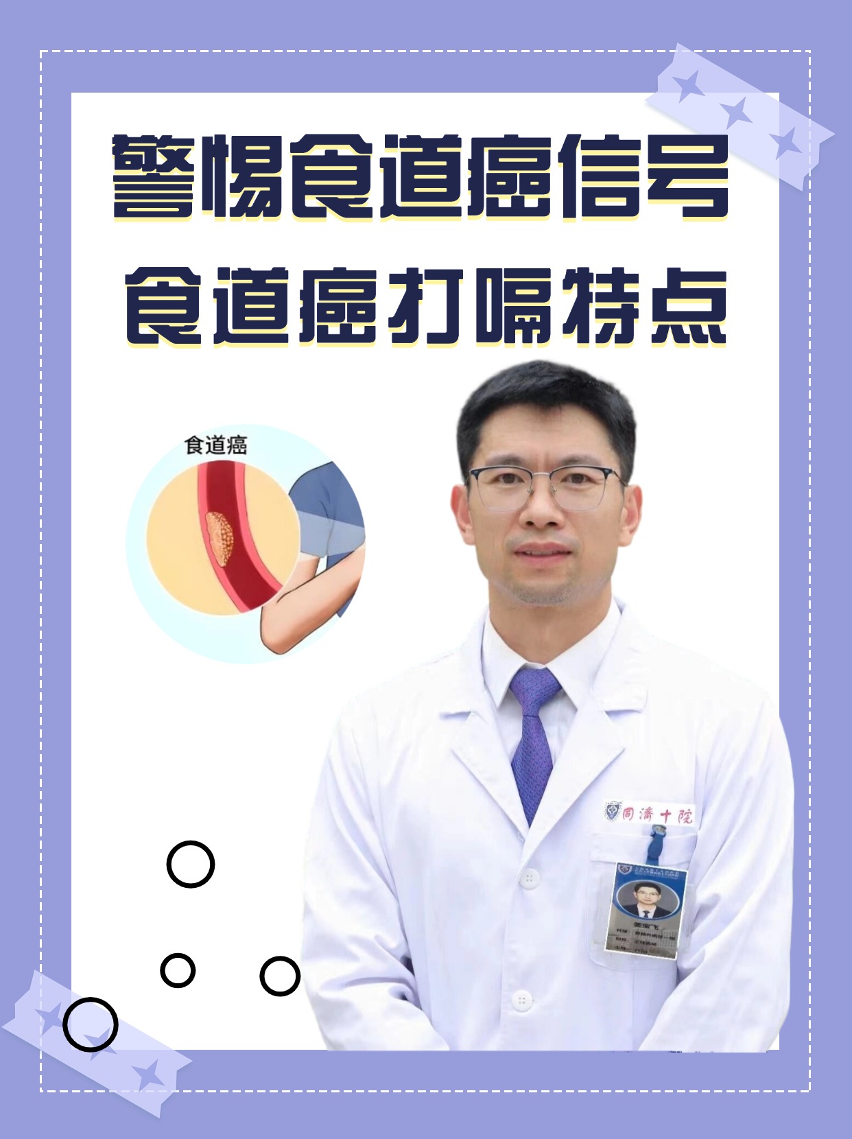 警惕食道癌信号：食道癌打嗝特点