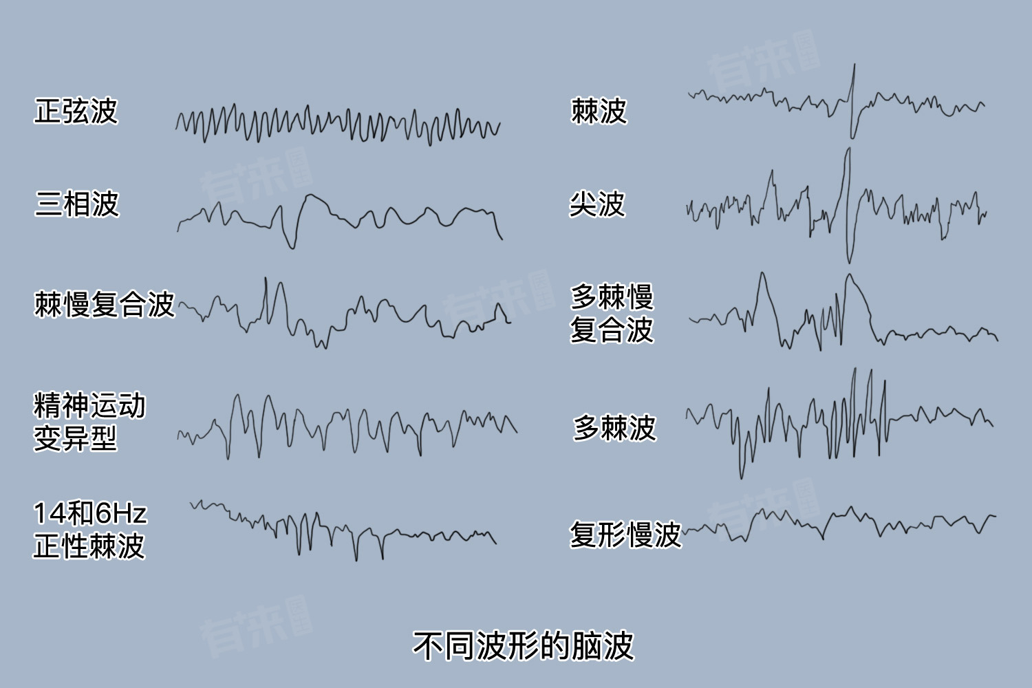 尖慢复合波是什么发作-有来医生