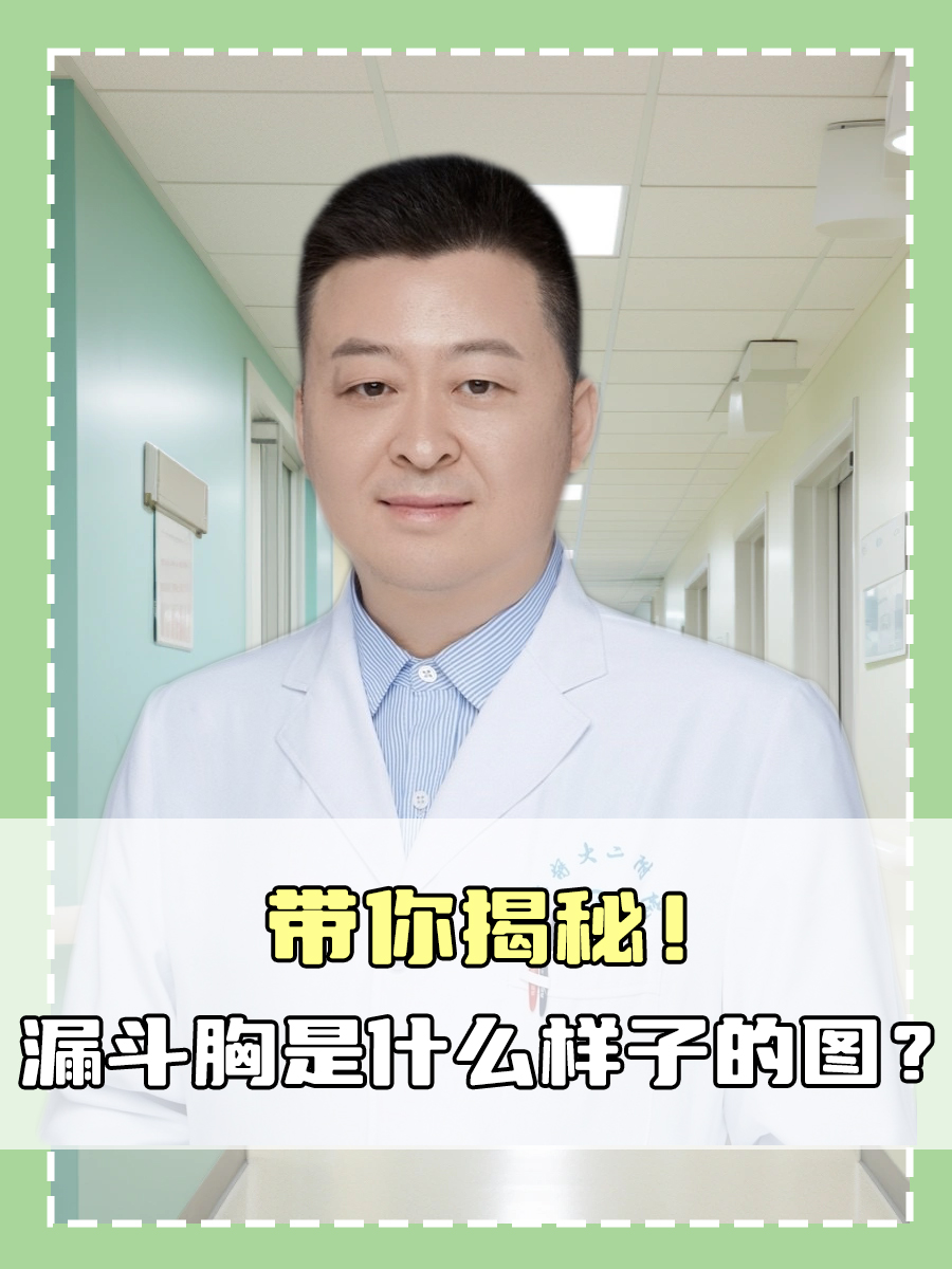带你揭秘！漏斗胸是什么样子的图？