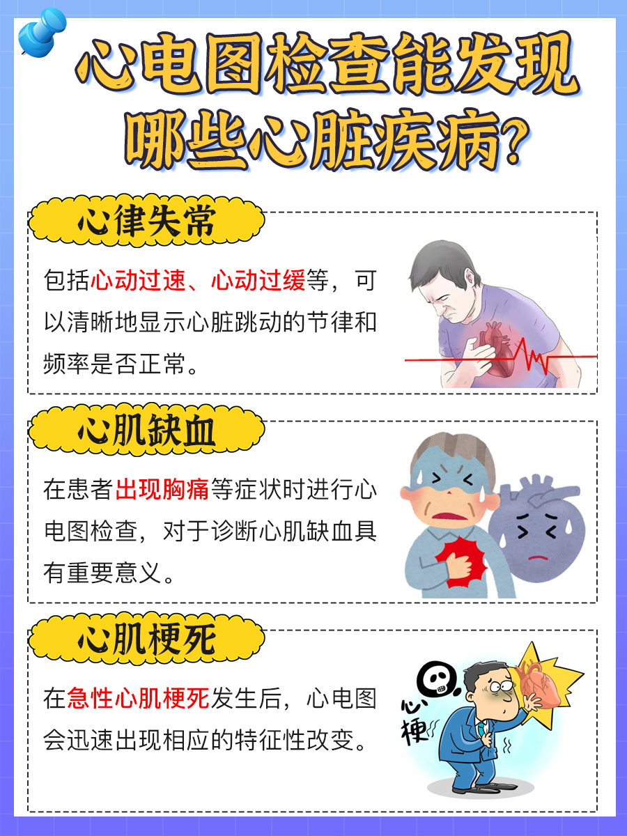 心电图大致正常算合格吗？医生为你解答