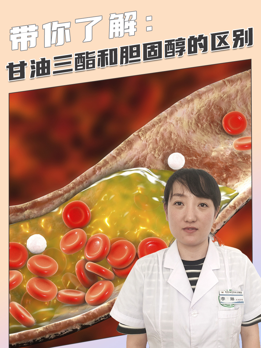 带你了解：甘油三酯和胆固醇的区别