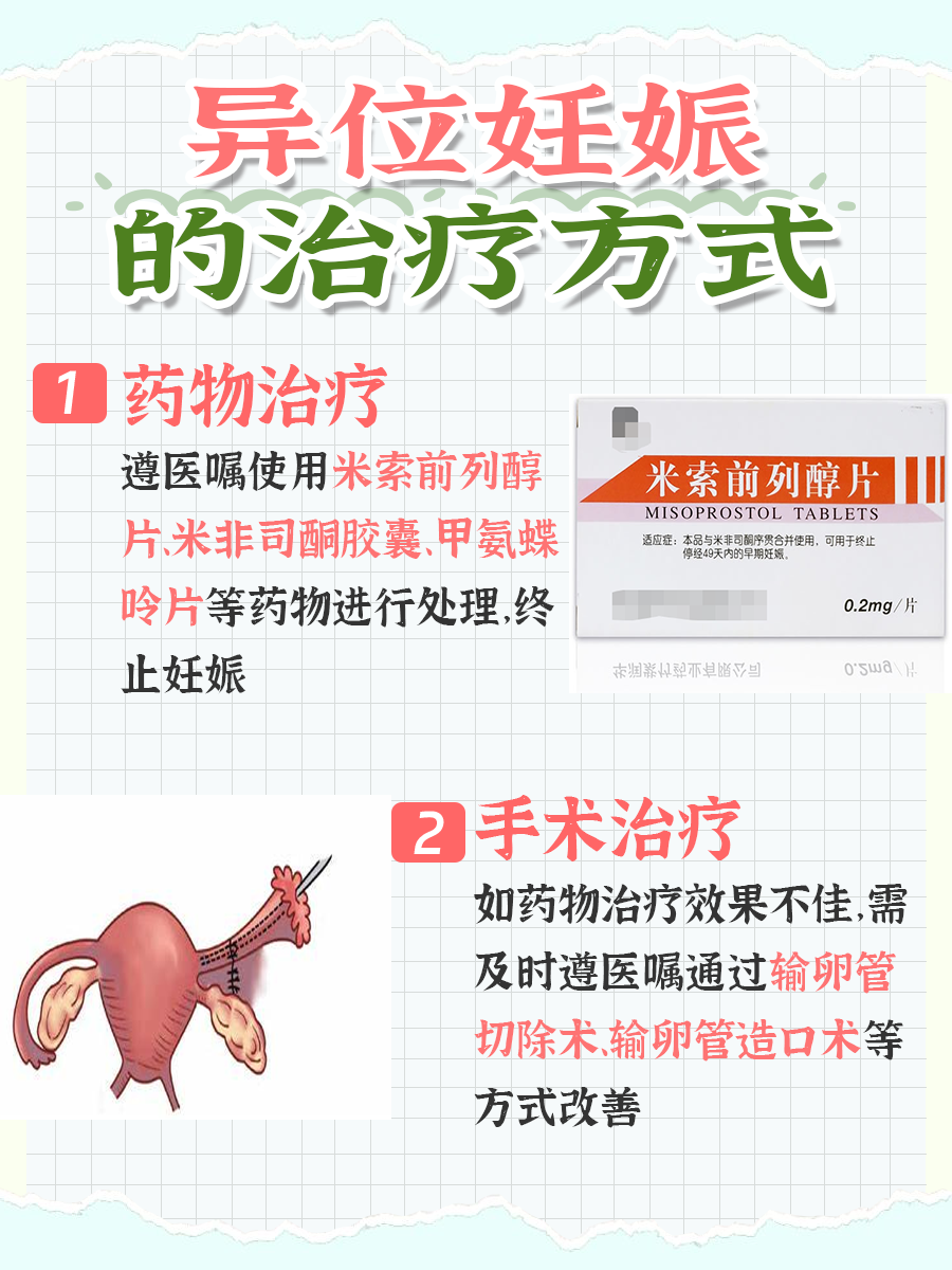 宫内孕VS宫外孕：孕期感受大不同，你知道吗？