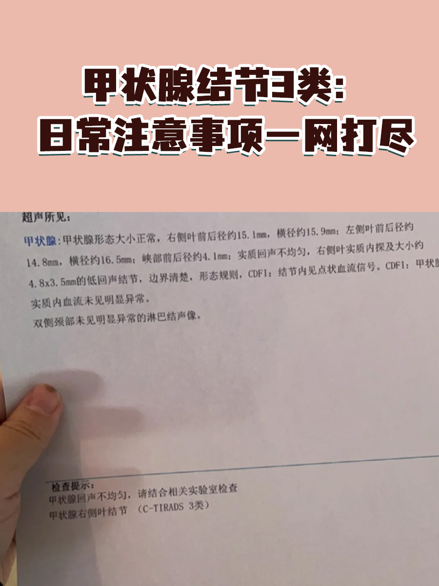 甲状腺结节3类：日常注意事项一网打尽