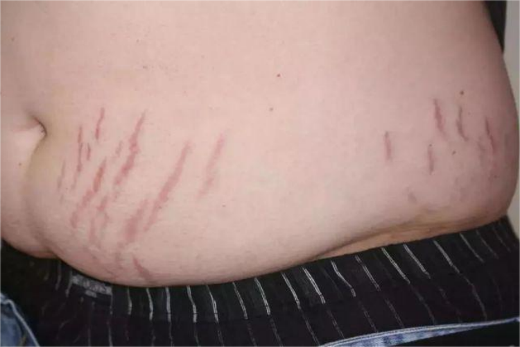 腰上有红色条纹图