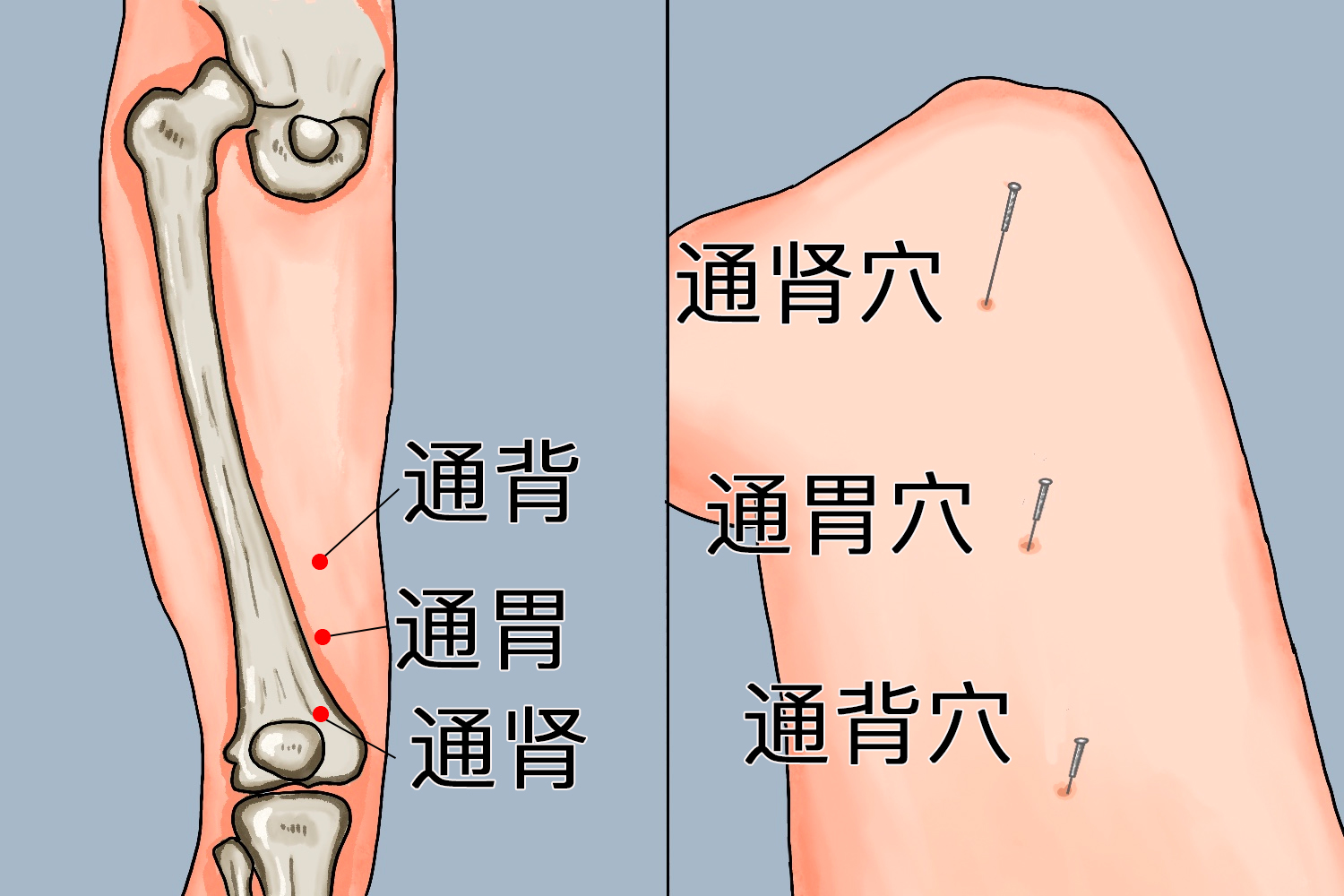 通肾、通胃、通背位置图