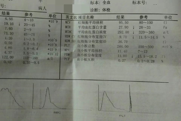 红细胞分布宽度CV偏低化验单图