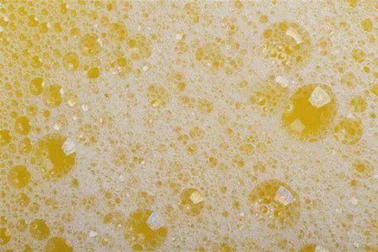 糖尿病患者尿液图