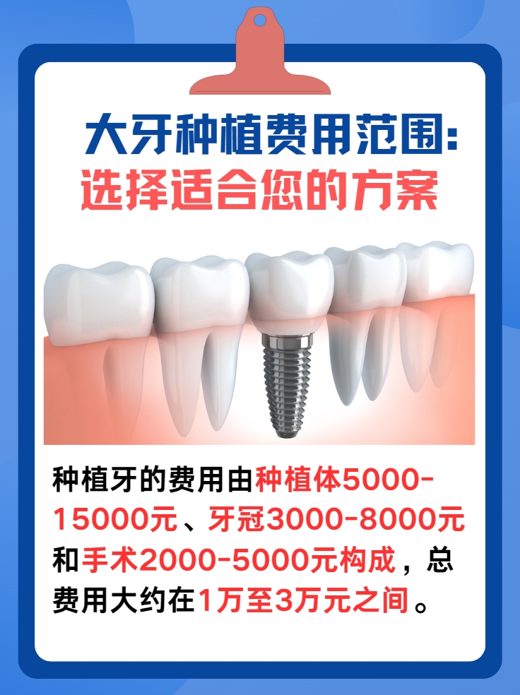 种植一颗大牙费用：为何价格不一