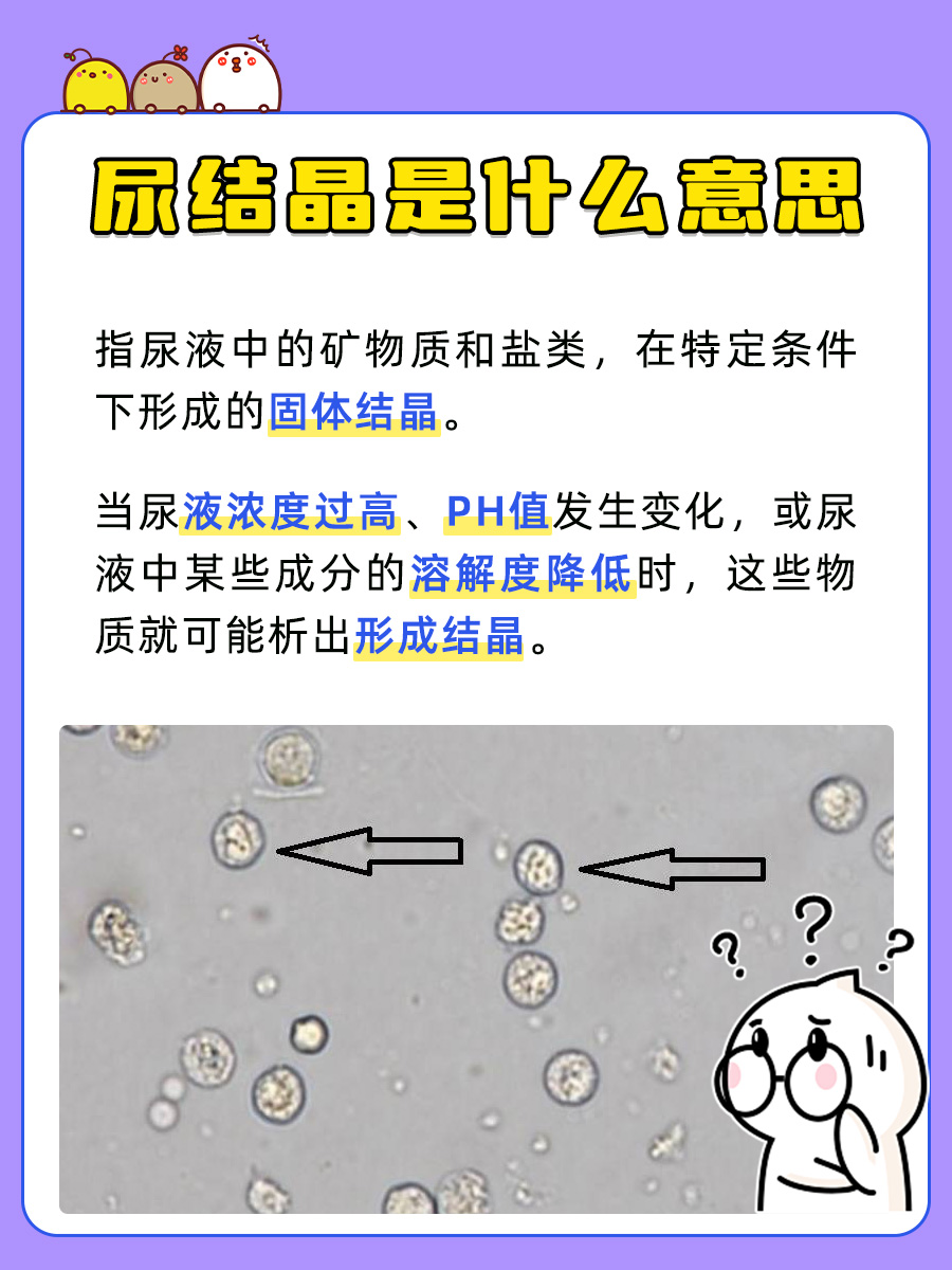 医学探究：尿结晶是什么意思