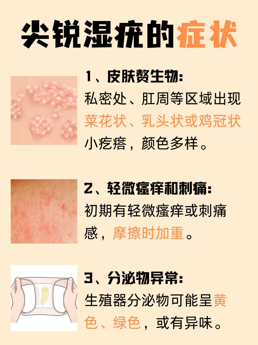 尖锐湿疣悄无声息？这些症状帮你揪出它！