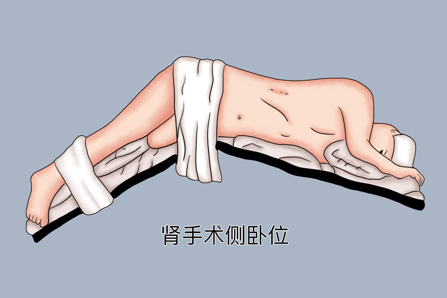 肾手术侧卧位图