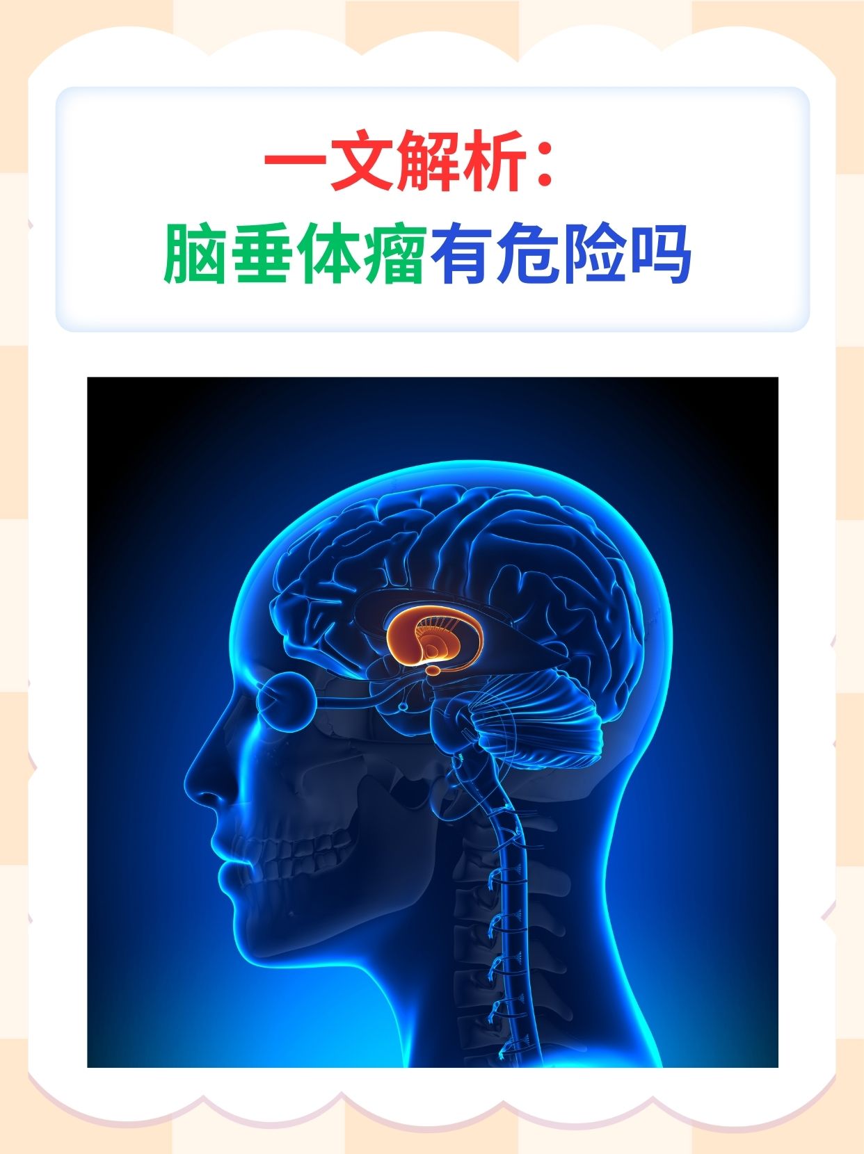 一文解析:脑垂体瘤有危险吗
