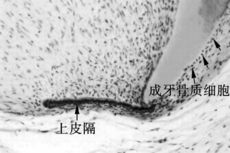 成牙骨质细胞形成图