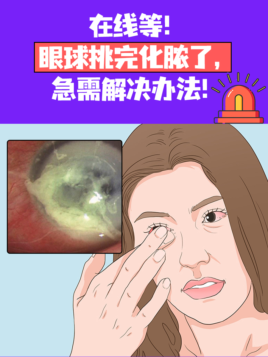 在线等！眼球挑完化脓了，急需解决办法！