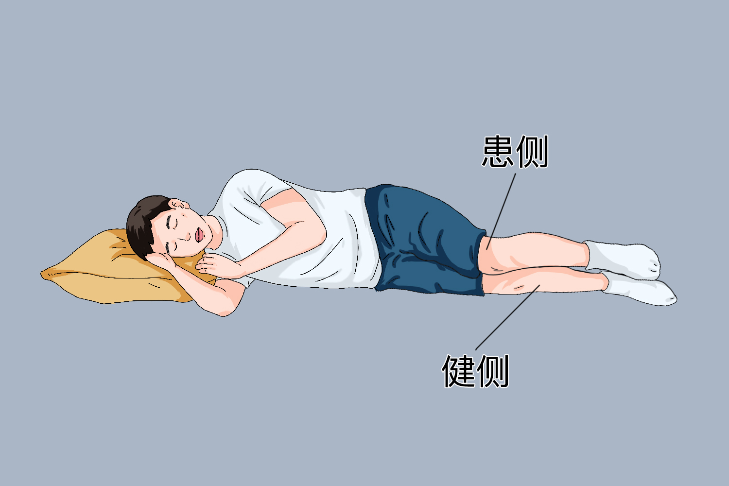 坐骨神经痛侧卧位睡姿图 坐骨神经痛侧卧位睡姿图