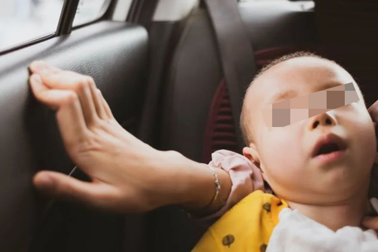 Menkes病患儿图 Menkes病患儿图