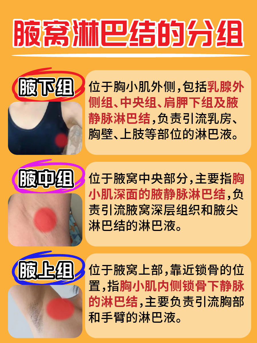 腋窝淋巴结竟然分三组？医生带你一探究竟