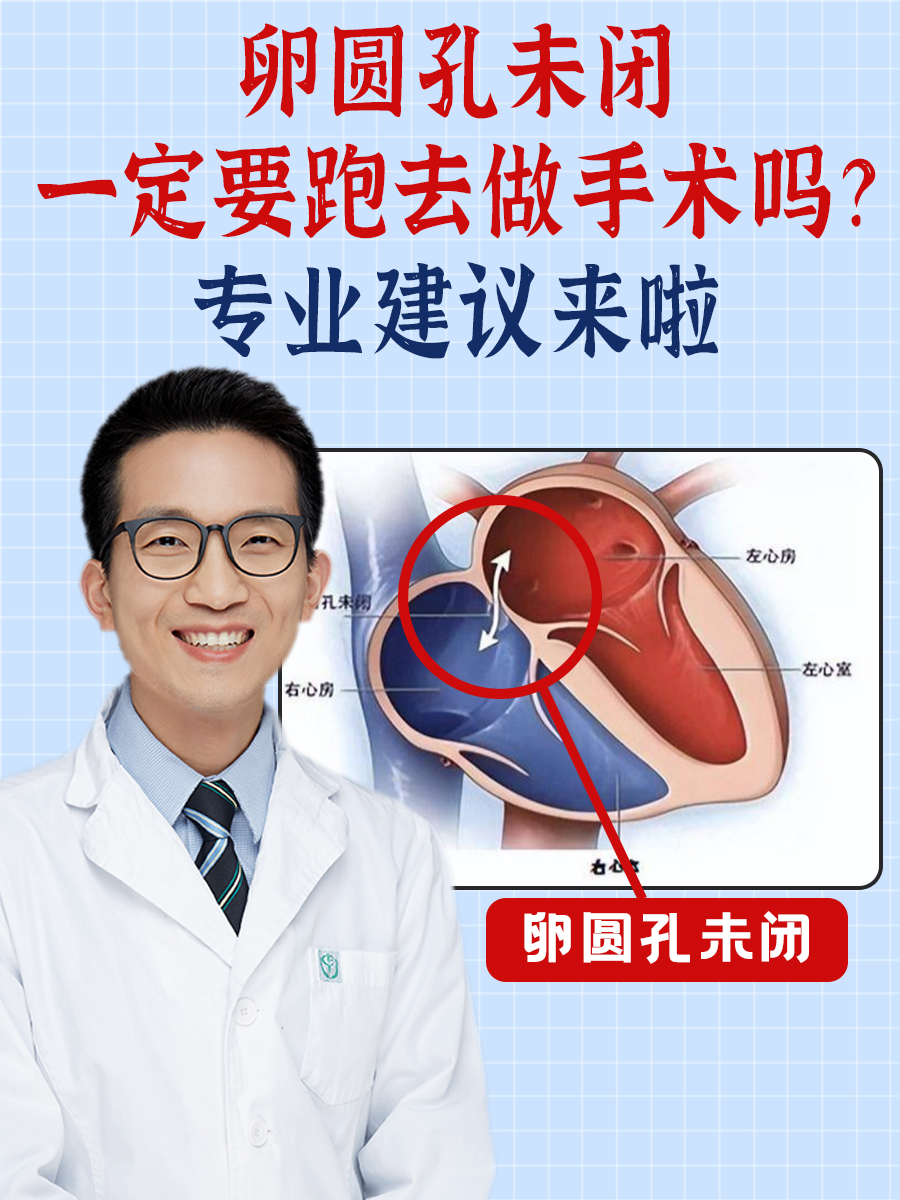 卵圆孔未闭,一定要跑去做手术吗?专业建议来啦