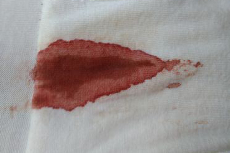 快生了宫颈粘液图