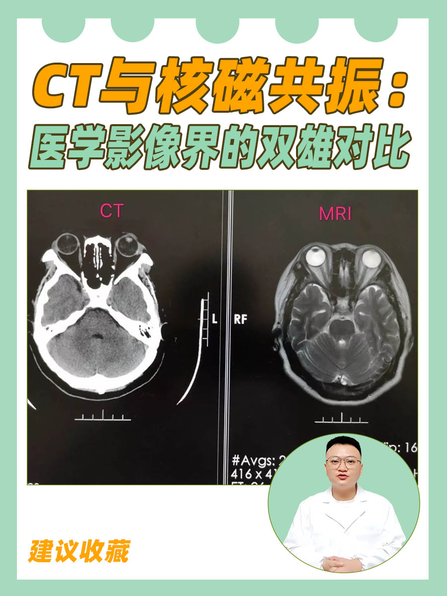 CT与核磁共振：医学影像界的双雄对比
