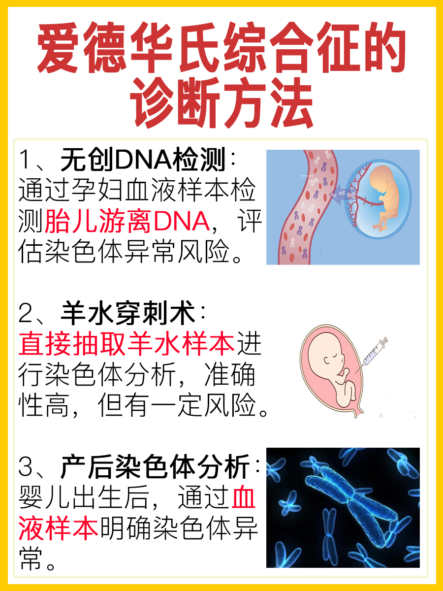 医生科普：爱德华氏综合征