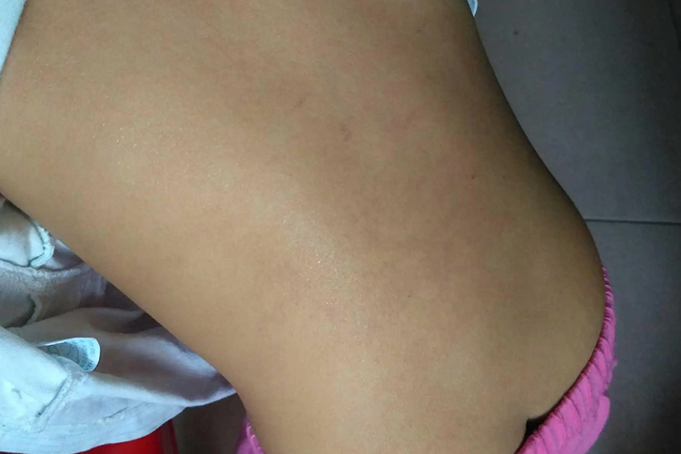 正常儿童后背图