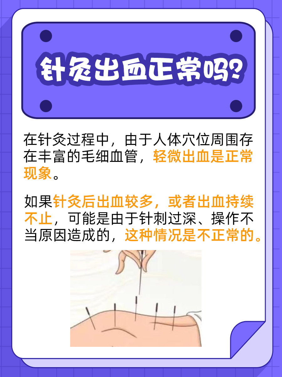 针灸出血,是正常现象还是警示信号?