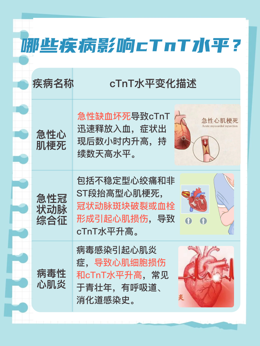 cTnT医学上代表什么？一文解析