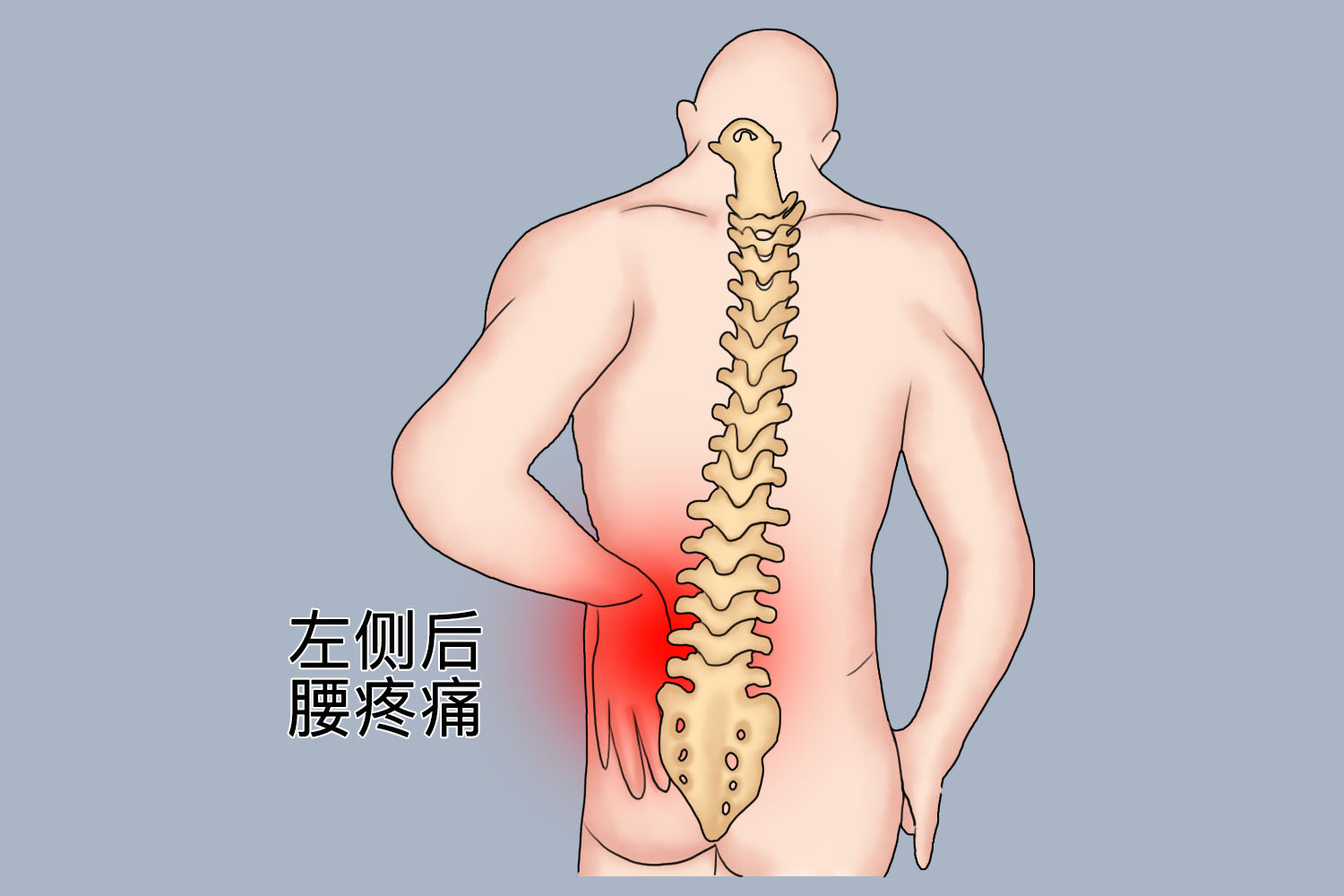 左侧后腰疼痛位置图