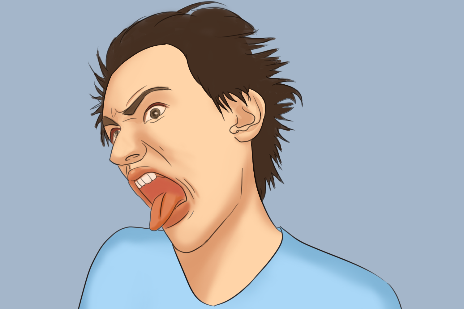 血卟啉病表情图