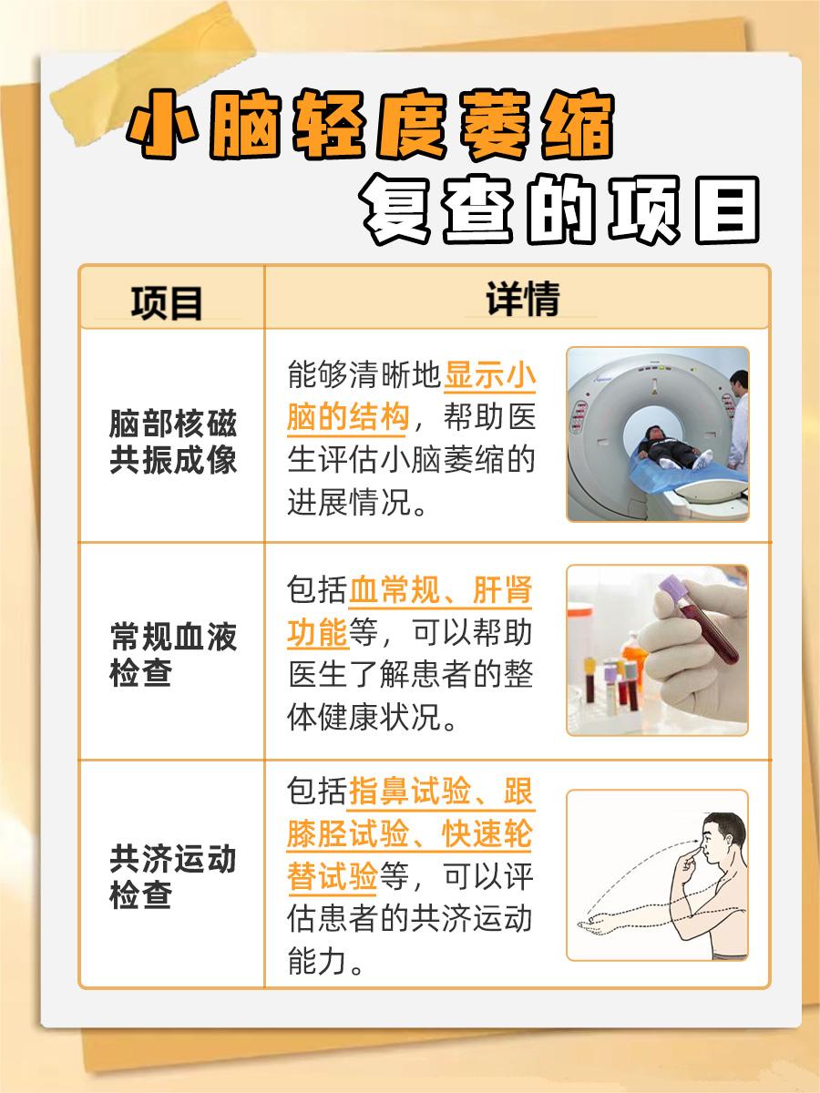 小脑轻度萎缩，别慌！科学应对方法在这里