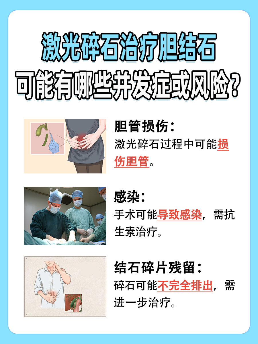 胆结石可以用激光碎石治疗吗？了解新技术