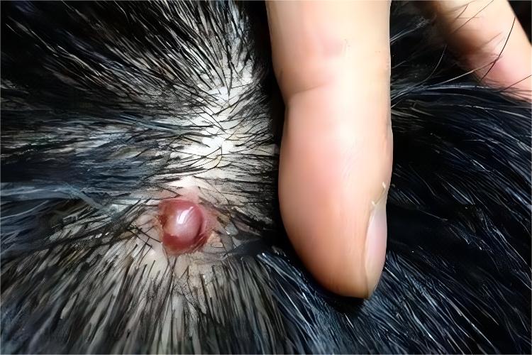 头上皮脂腺囊肿图 头上皮脂腺囊肿图