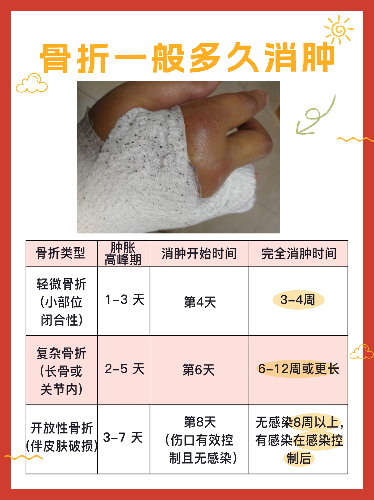 医生揭秘：骨折一般多久消肿