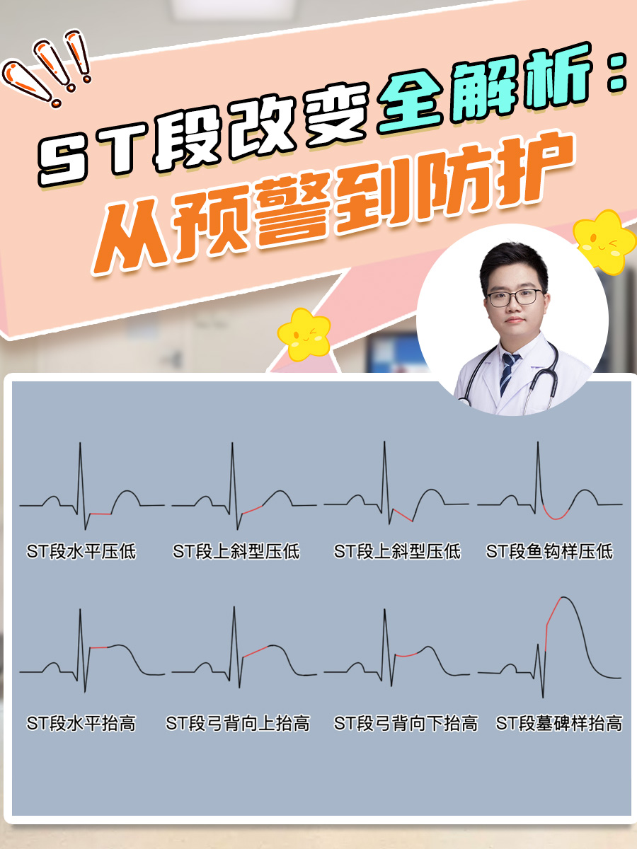 ST段改变全解析:从预警到防护