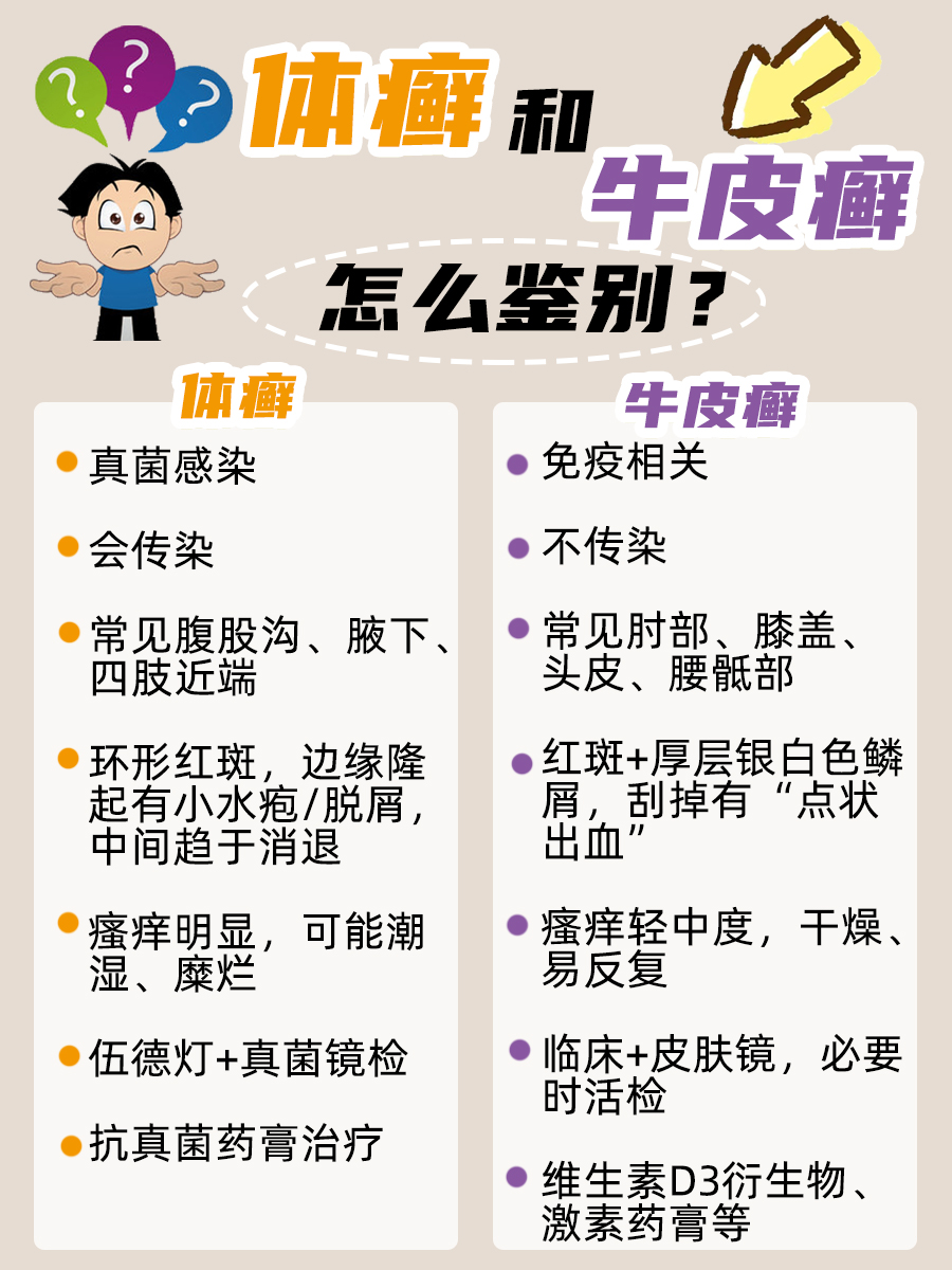 体癣和牛皮癣怎么鉴别?帮你一眼看穿!