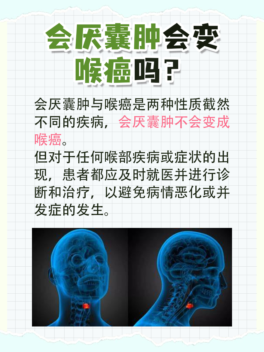 医生告诉你：会厌囊肿是否会发展为喉癌