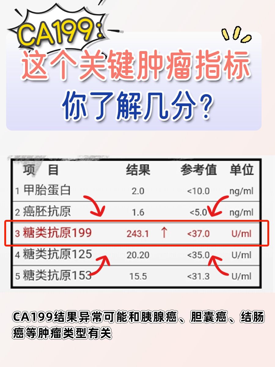 CA199：这个关键肿瘤指标你了解几分？