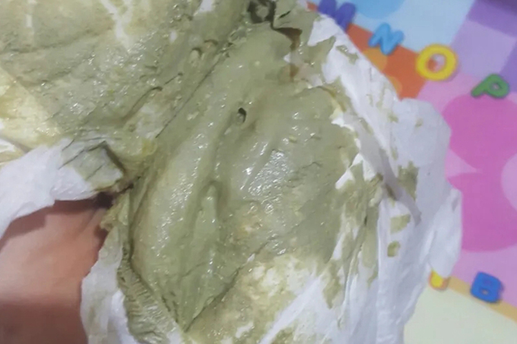 白陶土色大便图